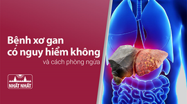 Giải đáp thắc mắc “Bệnh xơ gan có nguy hiểm không và cách phòng ngừa”
