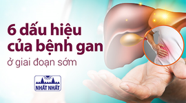 6 dấu hiệu của bệnh gan ở giai đoạn sớm giúp can thiệp kịp thời
