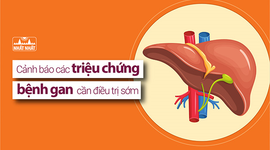 Cảnh báo các triệu chứng bệnh gan cần điều trị sớm