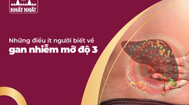 Những điều ít người biết về gan nhiễm mỡ độ 3