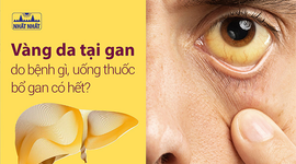 Vàng da tại gan do bệnh gì, uống thuốc bổ gan có hết?