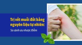 Trị vết muỗi đốt bằng nguyên liệu tự nhiên: So sánh ưu nhược điểm
