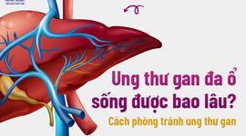 Ung thư gan đa ổ sống được bao lâu? Cách phòng tránh ung thư gan