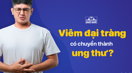 Viêm đại tràng có chuyển thành ung thư không?