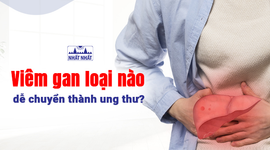 Tư vấn: Viêm gan loại nào dễ chuyển thành ung thư?