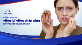 Giảm nhanh viêm lợi viêm chân răng không cần dùng thuốc