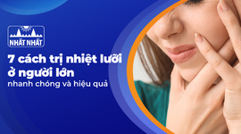 7 cách trị nhiệt lưỡi ở người lớn nhanh chóng và hiệu quả