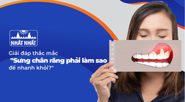 Giải đáp thắc mắc sưng chân răng phải làm sao để nhanh khỏi?