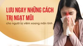 Lưu ngay những cách trị ngạt mũi cho người bị viêm xoang mãn tính