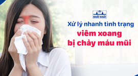 Xử lý nhanh tình trạng viêm xoang bị chảy máu mũi 