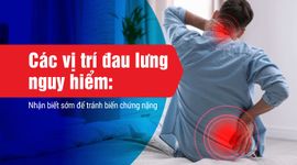 Các vị trí đau lưng nguy hiểm: Nhận biết sớm để tránh biến chứng nặng