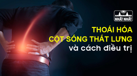 Thoái hóa cột sống thắt lưng: Nguyên nhân, triệu chứng và cách điều trị