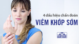 4 dấu hiệu chẩn đoán viêm khớp sớm và cách điều trị
