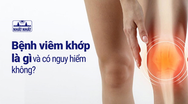 Bệnh viêm khớp là gì và có nguy hiểm không?
