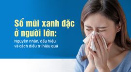 Sổ mũi xanh đặc ở người lớn: Nguyên nhân, dấu hiệu và cách điều trị