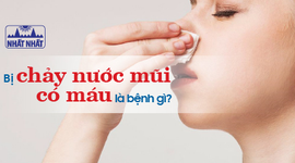 Bị chảy nước mũi có máu là bệnh gì? Có nguy hiểm không?
