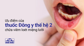 Ưu điểm đặc biệt của thuốc Đông y thế hệ 2 chữa viêm loét miệng lưỡi