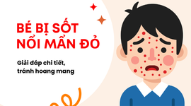 Bé bị sốt nổi mẩn đỏ: Giải đáp chi tiết, tránh hoang mang