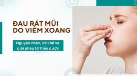 Đau rát mũi do viêm xoang: Nguyên nhân, cơ chế và giải pháp từ thảo dược
