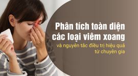 Phân tích toàn diện các loại viêm xoang và nguyên tắc điều trị hiệu quả từ chuyên gia