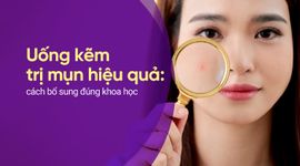 Uống kẽm trị mụn hiệu quả: cách bổ sung đúng khoa học