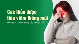 Các thảo dược tiêu viêm thông mũi cho người bị viêm xoang cấp và mạn tính