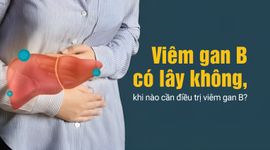 Viêm gan B có lây không, khi nào cần điều trị viêm gan B?