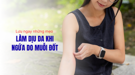 Lưu ngay 9 mẹo làm dịu da khi ngứa do muỗi đốt