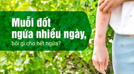 Muỗi đốt ngứa nhiều ngày, bôi gì cho hết ngứa?