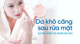 Da khô căng sau rửa mặt - sai lầm khiến da nhanh lão hóa
