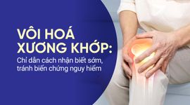 Vôi hoá xương khớp: Chỉ dẫn cách nhận biết sớm, tránh biến chứng nguy hiểm