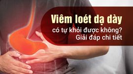 Viêm loét dạ dày có tự khỏi được không? Giải đáp chi tiết