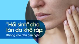 "Hồi sinh" cho làn da khô ráp: Không khó như bạn nghĩ!