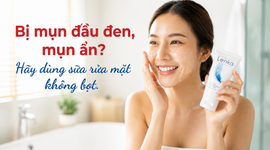 Bị mụn đầu đen, mụn ẩn? Hãy dùng sữa rửa mặt không bọt