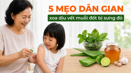5 mẹo dân gian xoa dịu vết muỗi đốt bị sưng đỏ