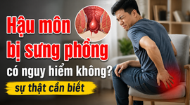 Hậu môn bị sưng phồng có nguy hiểm không? sự thật cần biết