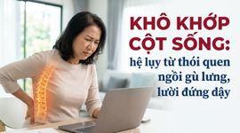 Khô khớp cột sống: hệ lụy từ thói quen ngồi gù lưng, lười đứng dậy