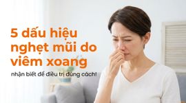 5 dấu hiệu nghẹt mũi do viêm xoang: nhận biết để điều trị đúng cách!