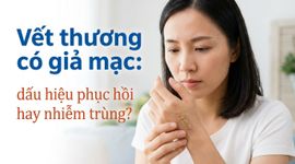 Vết thương có giả mạc: dấu hiệu phục hồi hay nhiễm trùng?