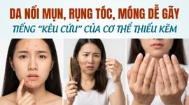 Da nổi mụn, rụng tóc, móng dễ gãy - tiếng "kêu cứu" của cơ thể thiếu kẽm
