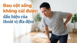 Đau cột sống không cúi được: dấu hiệu của thoát vị đĩa đệm