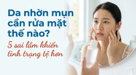 Da nhờn mụn cần rửa mặt thế nào? 5 sai lầm khiến tình trạng tệ hơn