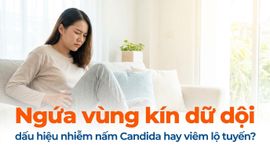 Ngứa vùng kín dữ dội - dấu hiệu nhiễm nấm Candida hay viêm lộ tuyến?