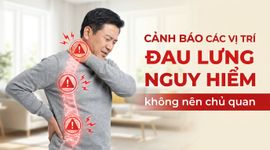 Cảnh báo các vị trí đau lưng nguy hiểm không nên chủ quan
