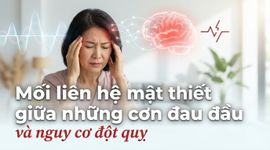Mối liên hệ mật thiết giữa những cơn đau đầu và nguy cơ đột quỵ