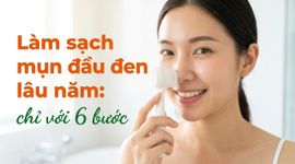 Làm sạch mụn đầu đen lâu năm: chỉ với 6 bước