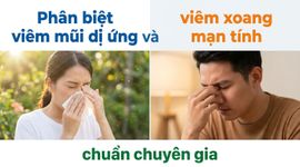 Phân biệt viêm mũi dị ứng và viêm xoang mạn tính chuẩn chuyên gia