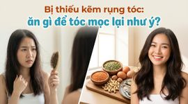 Bị thiếu kẽm rụng tóc: ăn gì để tóc mọc lại như ý?