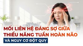 Mối liên hệ đáng sợ giữa thiểu năng tuần hoàn não và nguy cơ đột quỵ