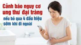 Cảnh báo nguy cơ ung thư đại tràng nếu bỏ qua 4 dấu hiệu sớm khi đi ngoài